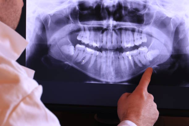 Best Emergency Dental Services for Seniors in Crystal Lake, IL