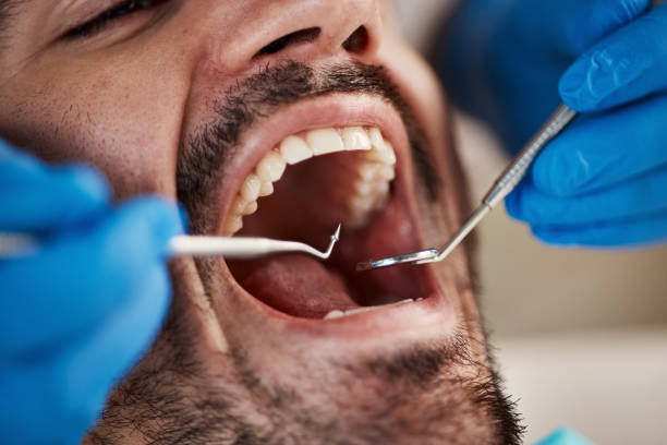 Best Emergency Root Canal Treatment in Crystal Lake, IL