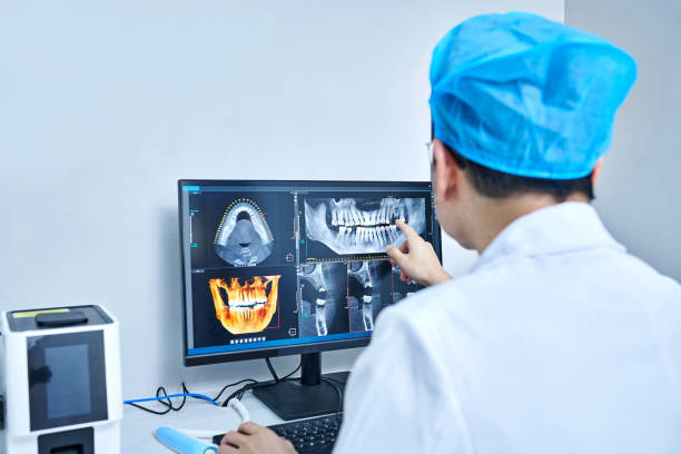 Best Emergency Dental Extractions in Crystal Lake, IL
