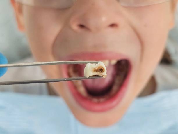 Best Emergency Cosmetic Dentistry in Crystal Lake, IL