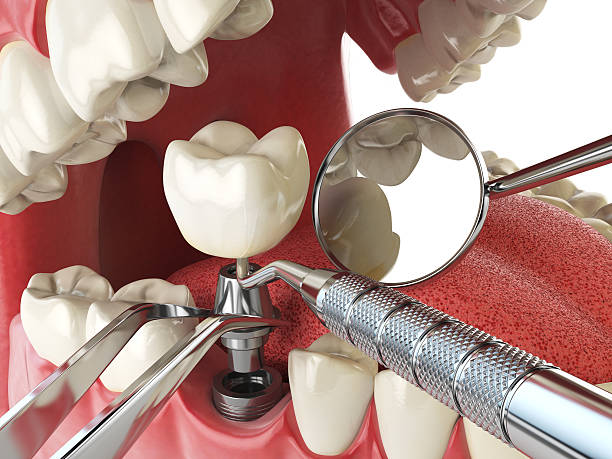 Best Emergency Dentist for Special Needs Patients in Crystal Lake, IL